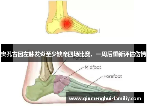 奥孔古因左膝发炎至少缺席四场比赛，一周后重新评估伤情